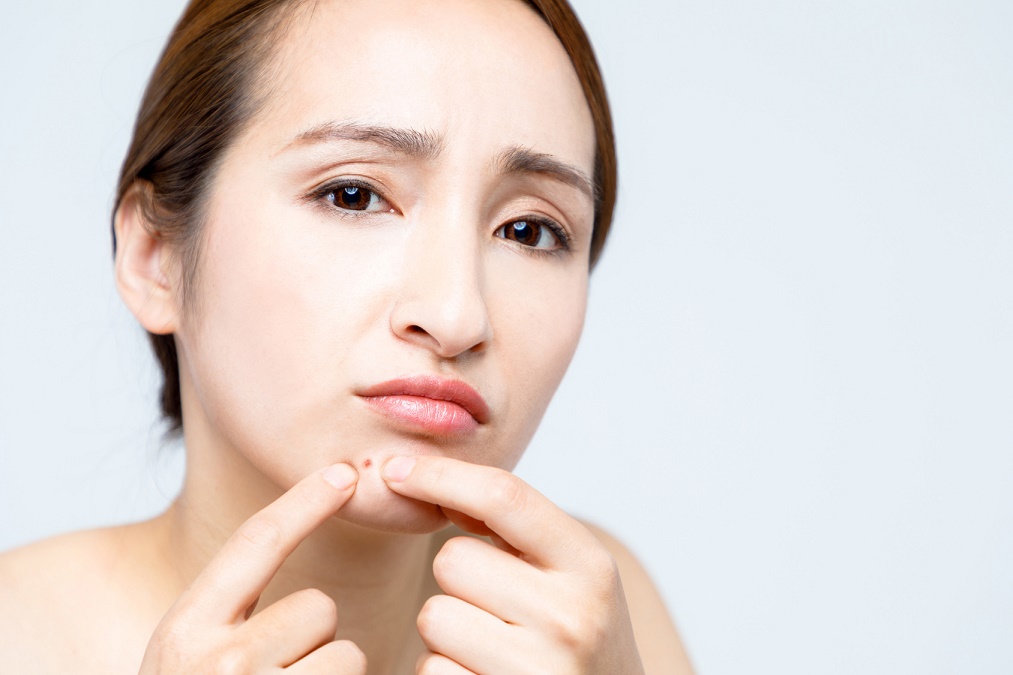 肌荒れを引き起こす女性ホルモンの乱れを改善する7つの方法